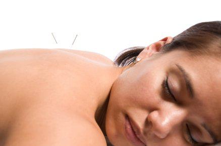 Acupuncture Patient